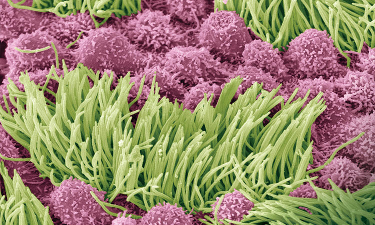 Photomicrograph of fallopian tube