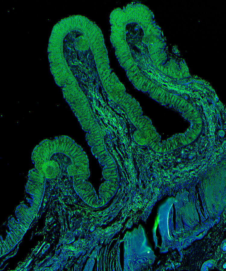 Beetles from all over the world regard themselves in the mirror and find that they are all left-handed circularly polarized